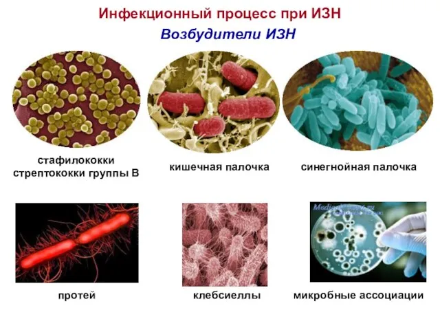 Инфекционный процесс при ИЗН Возбудители ИЗН стафилококки стрептококки группы В кишечная