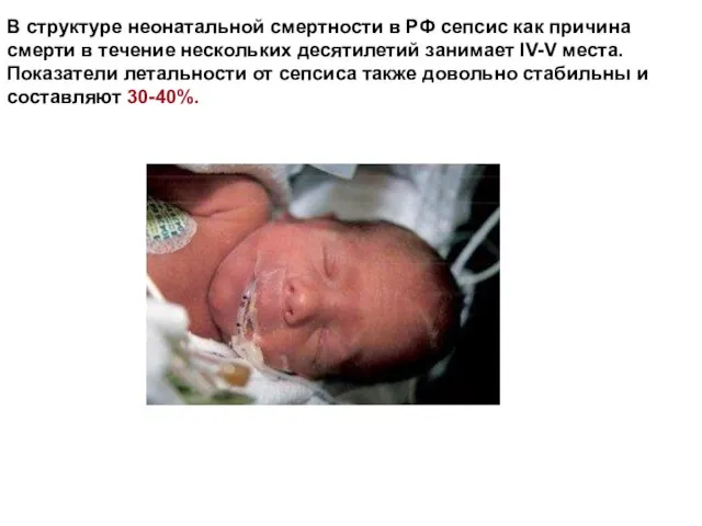 В структуре неонатальной смертности в РФ сепсис как причина смерти в