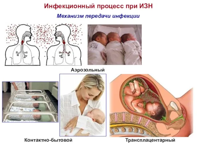 Инфекционный процесс при ИЗН Механизм передачи инфекции Аэрозольный Контактно-бытовой Трансплацентарный