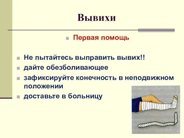 Вывихи Первая помощь Не пытайтесь выправить вывих!! дайте обезболивающее зафиксируйте конечность