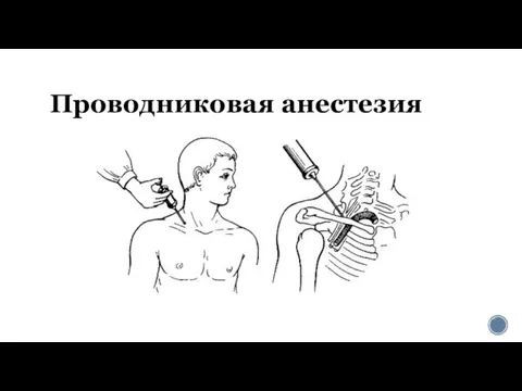 Проводниковая анестезия