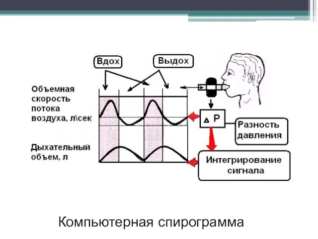 Компьютерная спирограмма