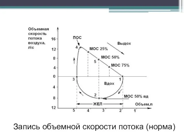 Запись объемной скорости потока (норма)