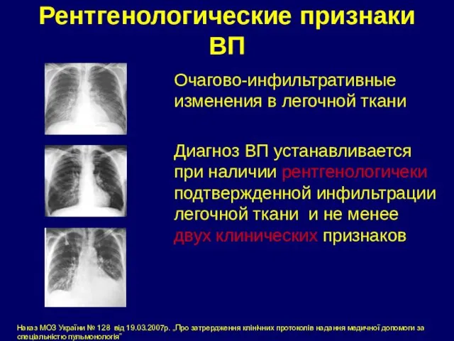 Рентгенологические признаки ВП Очагово-инфильтративные изменения в легочной ткани Диагноз ВП устанавливается