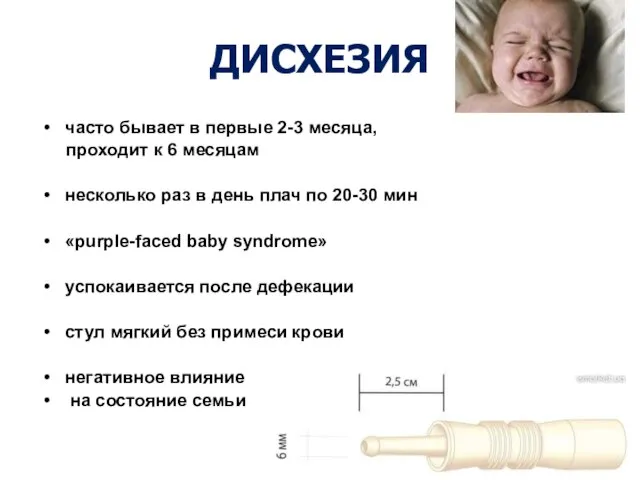 ДИСХЕЗИЯ часто бывает в первые 2-3 месяца, проходит к 6 месяцам