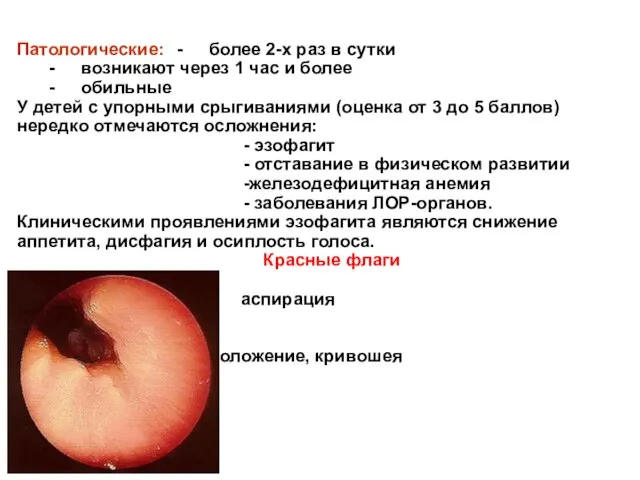 Патологические: - более 2-х раз в сутки - возникают через 1