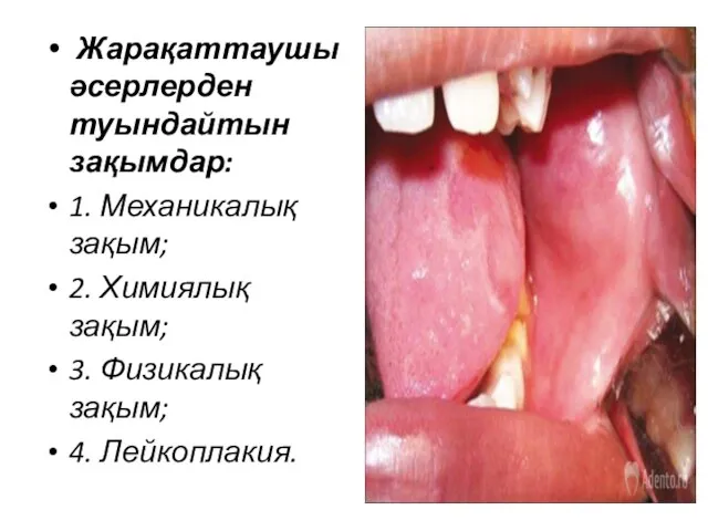 Жарақаттаушы әсерлерден туындайтын зақымдар: 1. Механикалық зақым; 2. Химиялық зақым; 3. Физикалық зақым; 4. Лейкоплакия.