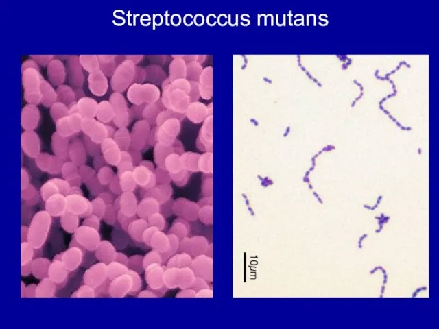 Streptococcus mutans