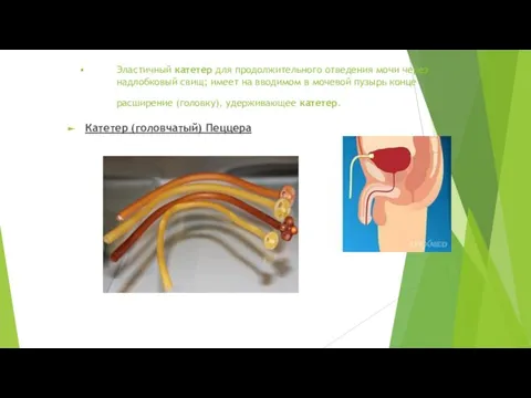 Эластичный катетер для продолжительного отведения мочи через надлобковый свищ; имеет на