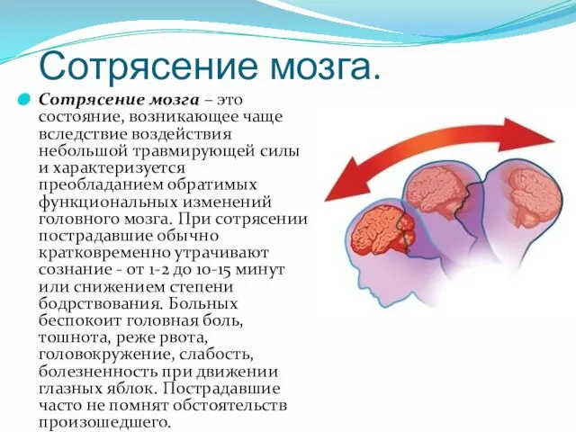 Сотрясение мозга. Сотрясение мозга – это состояние, возникающее чаще вследствие воздействия