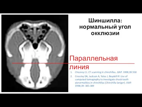 Параллельная линия Шиншилла: нормальный угол окклюзии Chesney CJ. CT scanning in