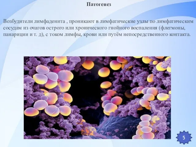 5 Патогенез Возбудители лимфаденита , проникают в лимфатические узлы по лимфатическим