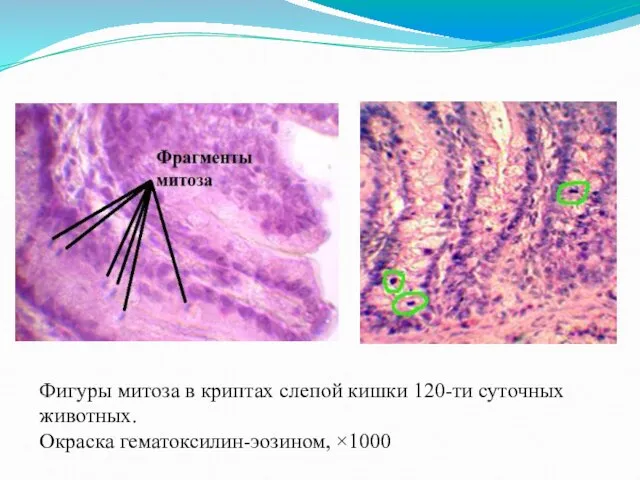 Фигуры митоза в криптах слепой кишки 120-ти суточных животных. Окраска гематоксилин-эозином, ×1000