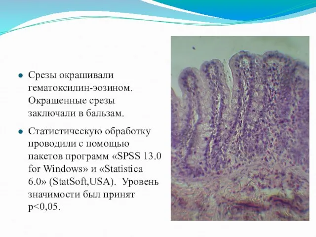 Срезы окрашивали гематоксилин-эозином. Окрашенные срезы заключали в бальзам. Статистическую обработку проводили