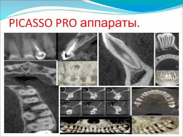 PICASSO PRO аппараты.