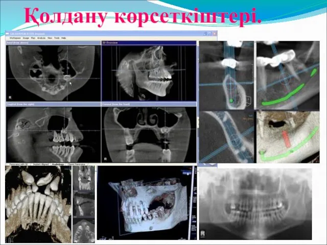 Қолдану көрсеткіштері.