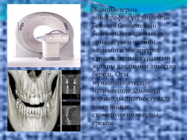 Компьютерлік томография үш өлшемді бейнені бейнелейтін болғандықтан, ағзаның орналасуын, пішінін, өлшемін