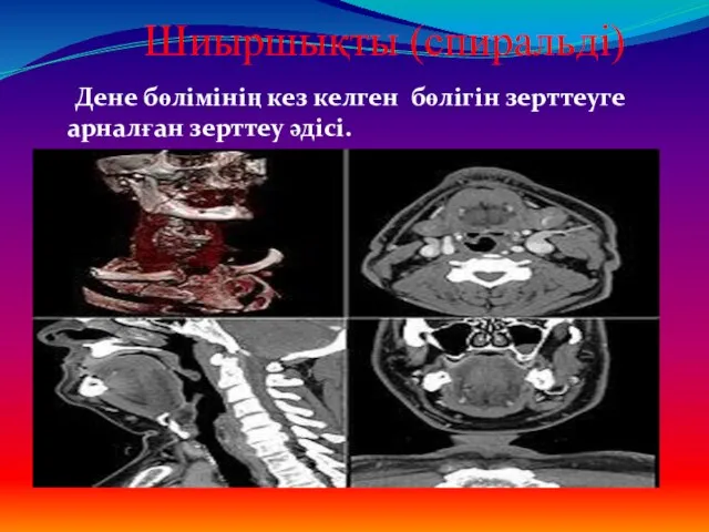 Шиыршықты (спиральді) Дене бөлімінің кез келген бөлігін зерттеуге арналған зерттеу әдісі.