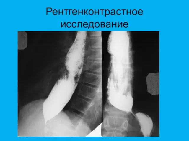 Рентгенконтрастное исследование