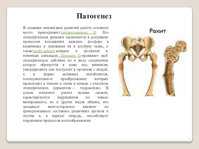 В сложных механизмах развития рахита основное место принадлежит гиповитаминозу D. Его