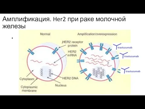 Амплификация. Her2 при раке молочной железы