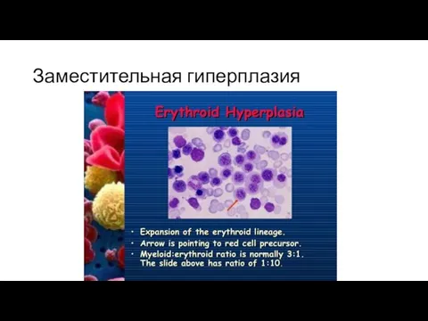 Заместительная гиперплазия