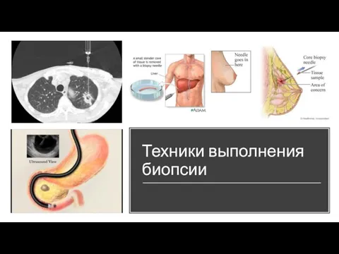 Техники выполнения биопсии