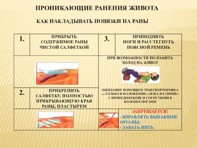 ПРОНИКАЮЩИЕ РАНЕНИЯ ЖИВОТА КАК НАКЛАДЫВАТЬ ПОВЯЗКИ НА РАНЫ