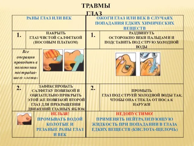 ТРАВМЫ ГЛАЗ