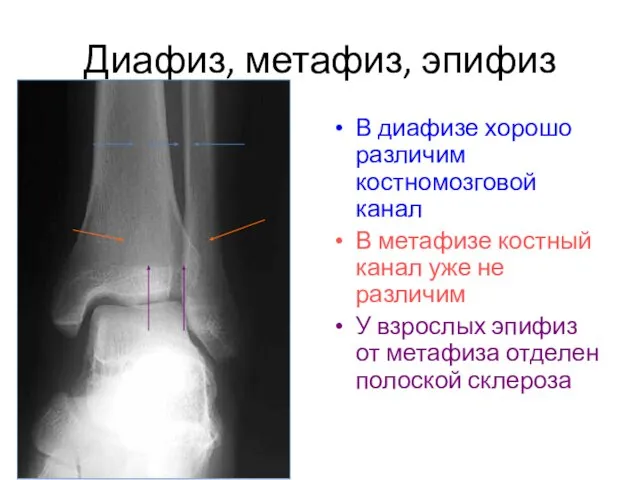 Диафиз, метафиз, эпифиз В диафизе хорошо различим костномозговой канал В метафизе