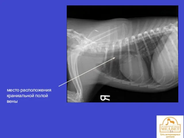 место расположения краниальной полой вены