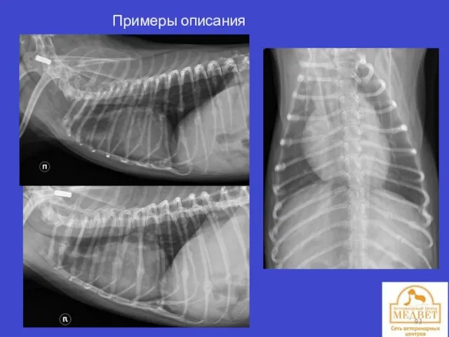 Примеры описания рентгенограмм.