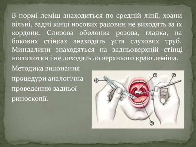 В нормі леміш знаходиться по средній лінії, хоани вільні, задні кінці