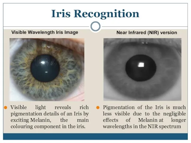 Visible light reveals rich pigmentation details of an Iris by exciting