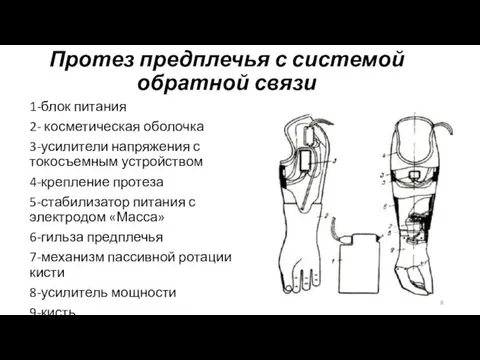 Протез предплечья с системой обратной связи 1-блок питания 2- косметическая оболочка