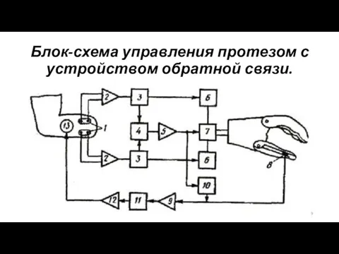 Блок-схема управления протезом с устройством обратной связи.