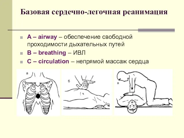 Базовая сердечно-легочная реанимация A – airway – обеспечение свободной проходимости дыхательных