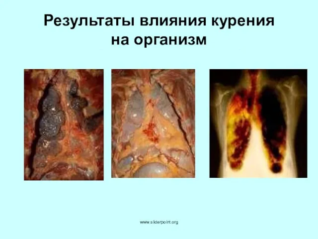 Результаты влияния курения на организм www.sliderpoint.org