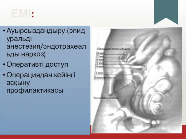 ЕМІ: Ауырсыздандыру.(эпидуральді анестезия/эндотрахеальды наркоз) Оперативті доступ Операциядан кейінгі асқыну профилактикасы