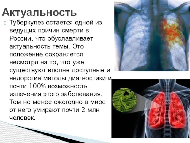 Туберкулез остается одной из ведущих причин смерти в России, что обуславливает