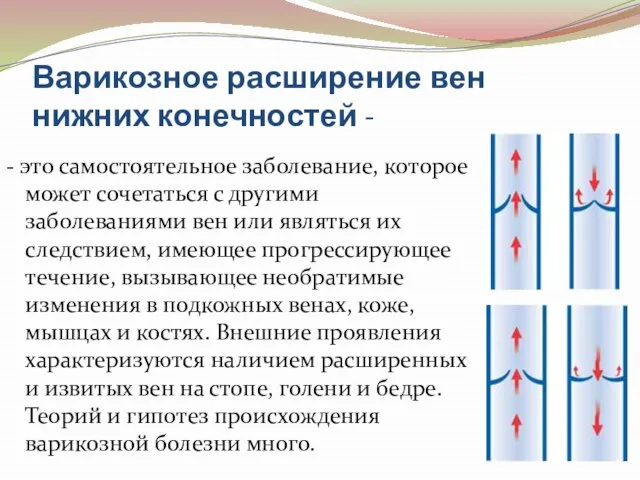 Варикозное расширение вен нижних конечностей - - это самостоятельное заболевание, которое