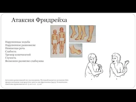 Атаксия Фридрейха Аутосомно-рецессивный тип наследования. Мутацией является экспансия GAA тринуклеотидных повторов