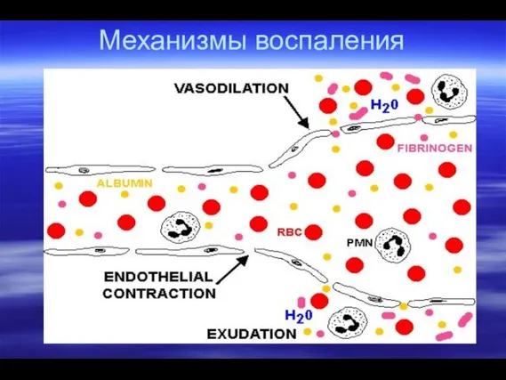 Механизмы воспаления