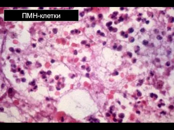 ПМН-клетки