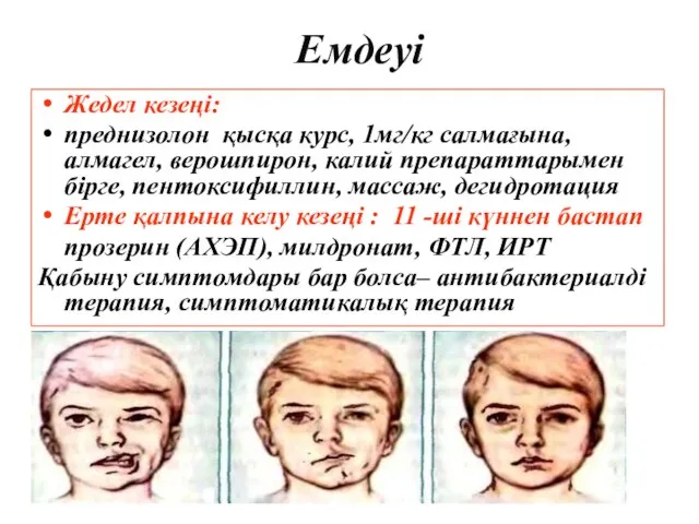 Емдеуі Жедел кезеңі: преднизолон қысқа курс, 1мг/кг салмағына, алмагел, верошпирон, калий