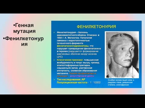 Генная мутация Фенилкетонурия