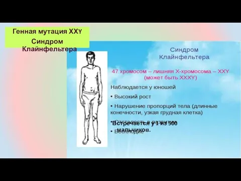 Встречается у 1 из 500 мальчиков. Генная мутация ХХY Синдром Клайнфельтера