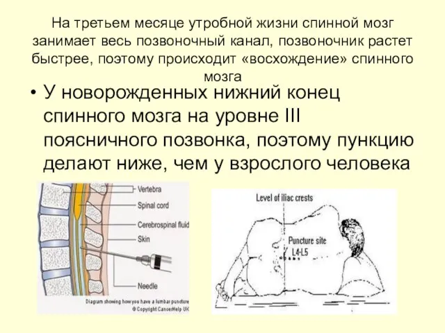 На третьем месяце утробной жизни спинной мозг занимает весь позвоночный канал,