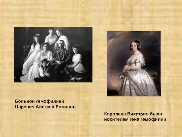 Королева Виктория была носителем гена гемофилии Больной гемофилией Царевич Алексей Романов
