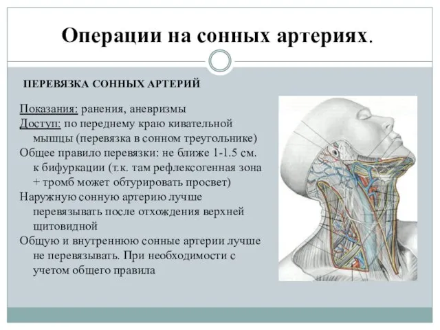 Операции на сонных артериях. Показания: ранения, аневризмы Доступ: по переднему краю